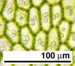 CC BY-NC David Wagner cells with oil bodies