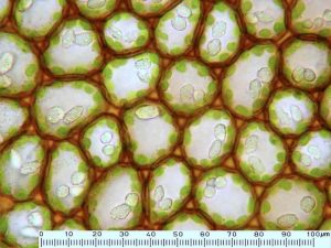 CC BY-NC David Wagner cells with oil bodies
